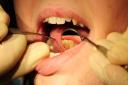 There is a surge of people living in pain as the nation struggles to pay for dental care amid the mass culling of NHS dentists in England